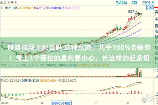 股票能网上配资吗 这种息肉，几乎100%会癌变！身上3个部位的息肉要小心，长这样的赶紧切