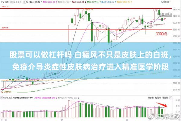 股票可以做杠杆吗 白癜风不只是皮肤上的白斑，免疫介导炎症性皮肤病治疗进入精准医学阶段